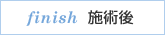 finish 施術後